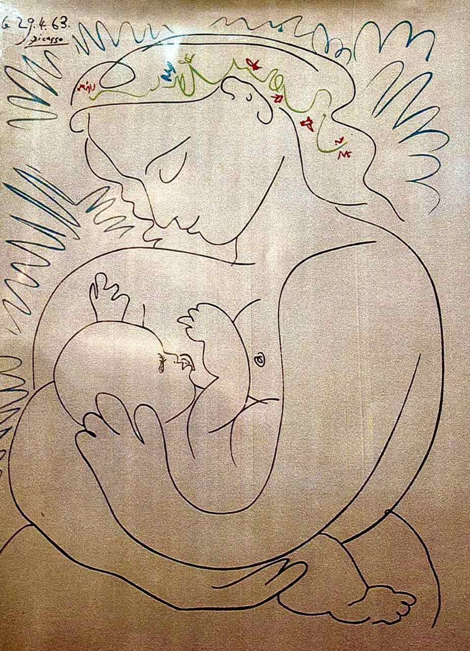Fragile X syndrome: what impact on the course of IVF?